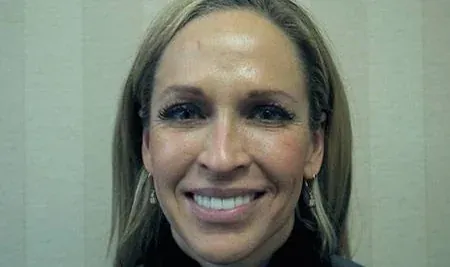 A real patient of Dr. Bjorklund showing her new smile.